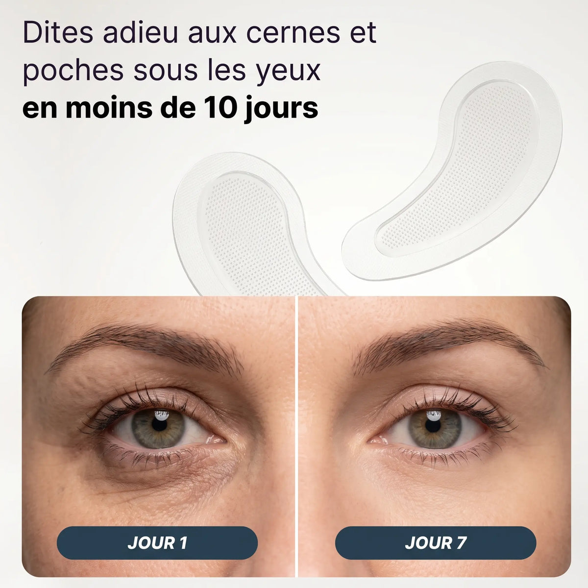 Patchs anti-cernes microneedling - Nouvelle génération