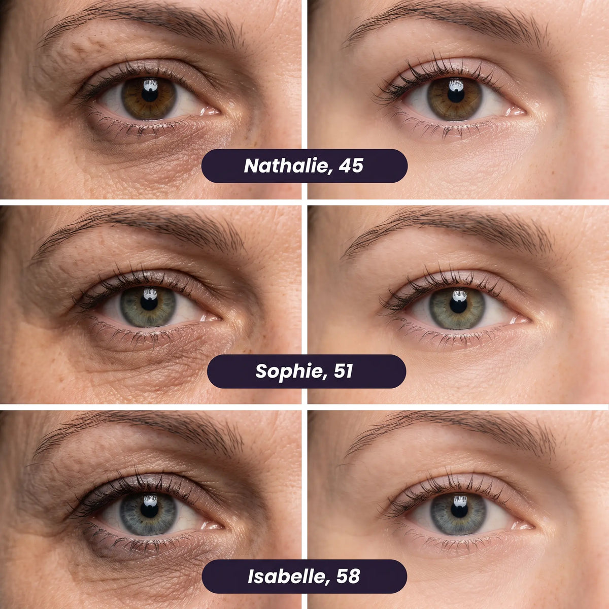 Patchs anti-cernes microneedling - Nouvelle génération