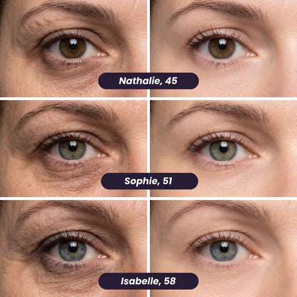 Patchs anti-cernes microneedling - Nouvelle génération